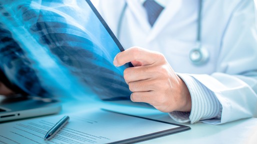 close up of male doctor holding x-ray or roentgen image