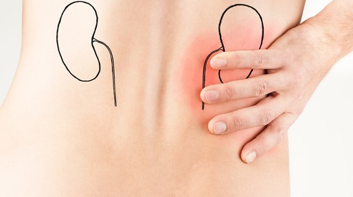 renal colic – male adult – kidney disease